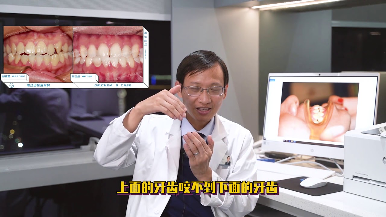 骨性牙齿矫正