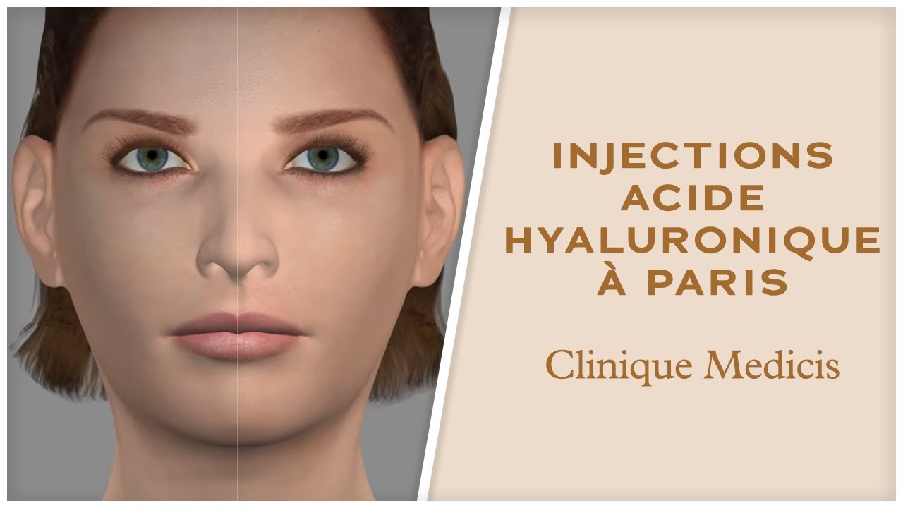 Acide hyaluronique à Paris : Dr ABBOU et Dr PESSIS explication du vieillissement du visage