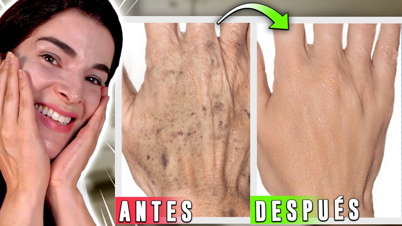 &iexcl;Lo Mejor para MANOS SECAS con ARRUGAS y MANCHAS!