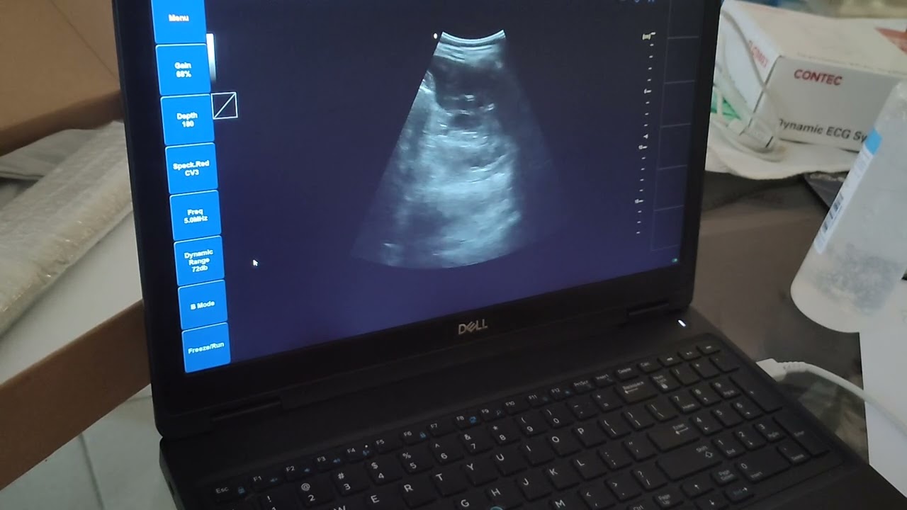 ECOGRAFO ULTRASOUND TOUCH CONVEXO - DEMOSTRACION