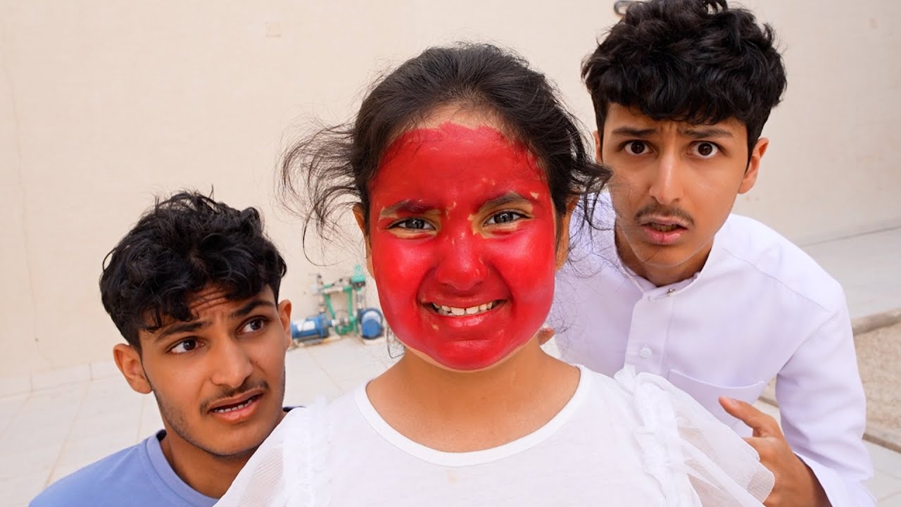 ليلى فجعتنا بوجهها الأحمر 😱!! قررنا نوديها المستشفى وبعدين صدمتنا!