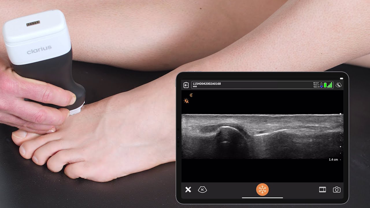 How to Scan Small Joints: Ultrasound Scanning Technique