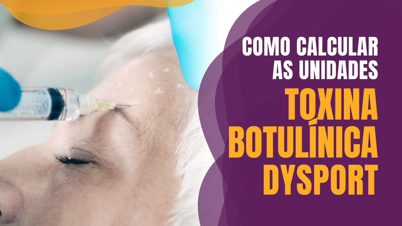 Como calcular as unidades da Toxina Botulínica Dysport