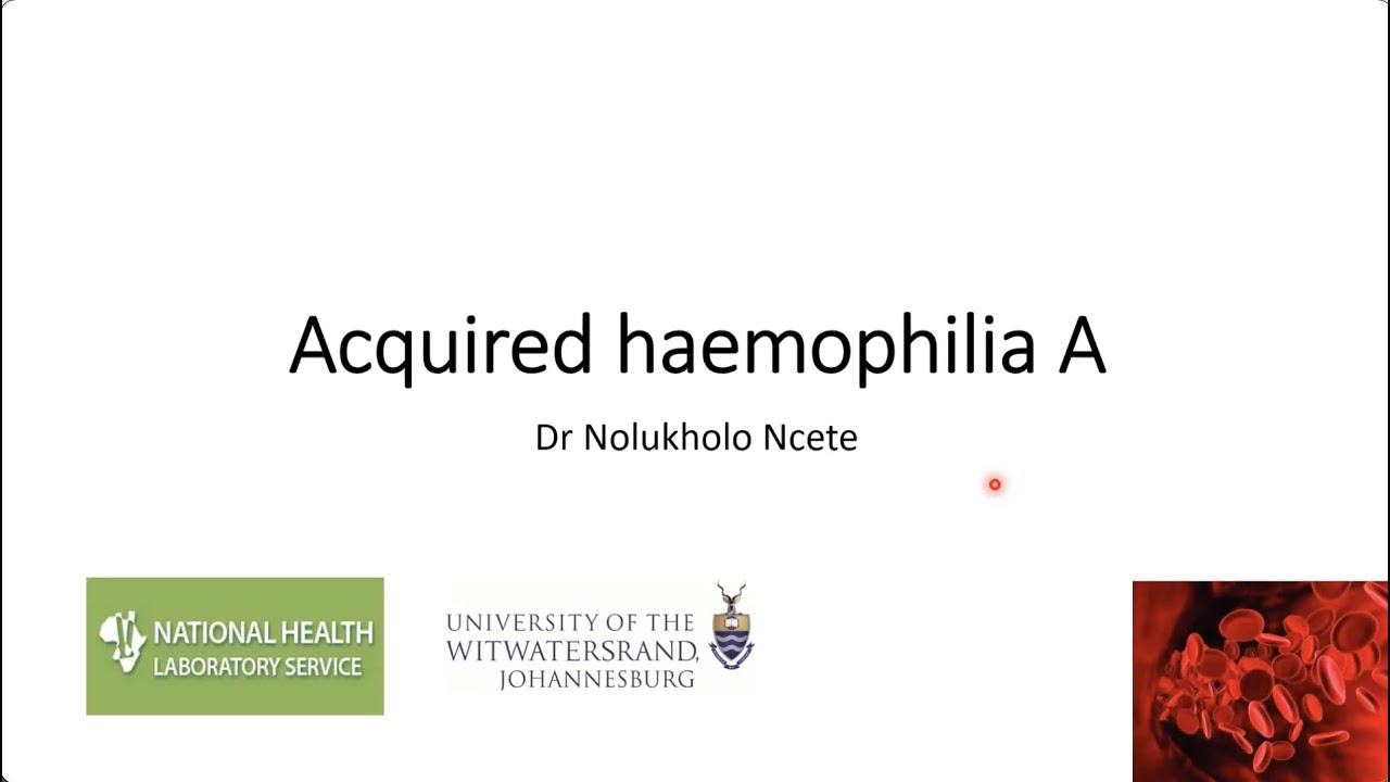 Acquired Haemophilia
