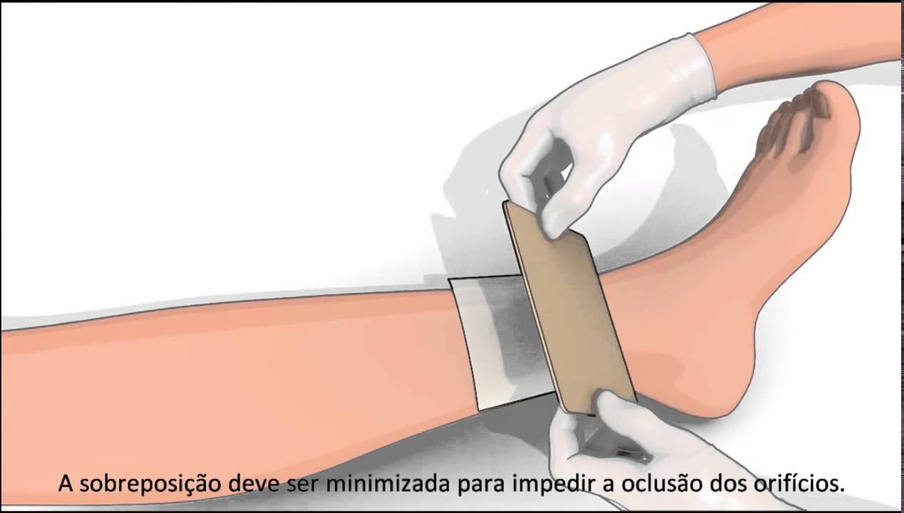 Vitae Saúde - Curativo Adaptic -  Malha não aderente - Modo de usar