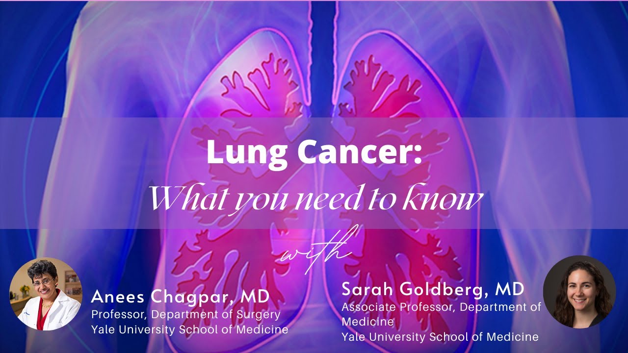 LUNG CANCER:  What you need to know... from risk reduction, to screening, to novel treatments