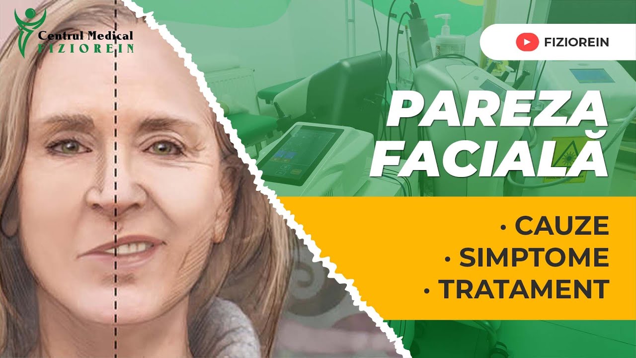 Pareza faciala periferica- Centrul Medical Fiziorein