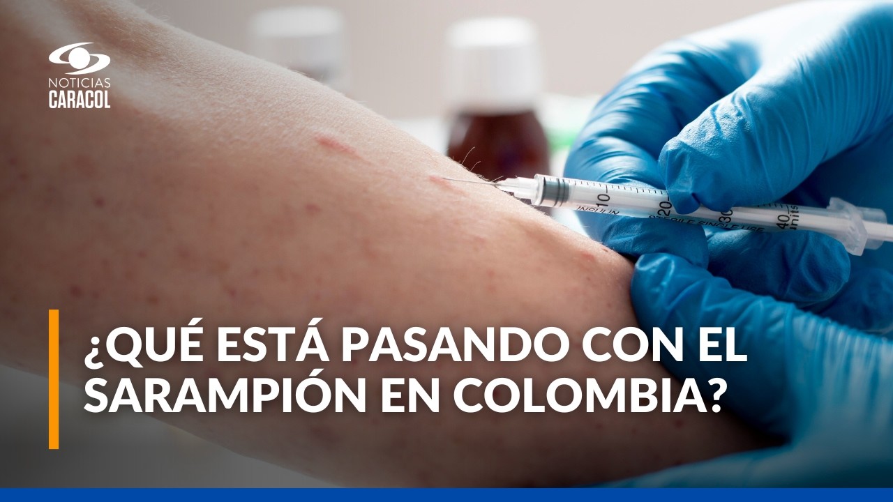 ¿Viaja al exterior o asistirá al Mundial 2026? Ojo con su esquema de vacunación contra el sarampión