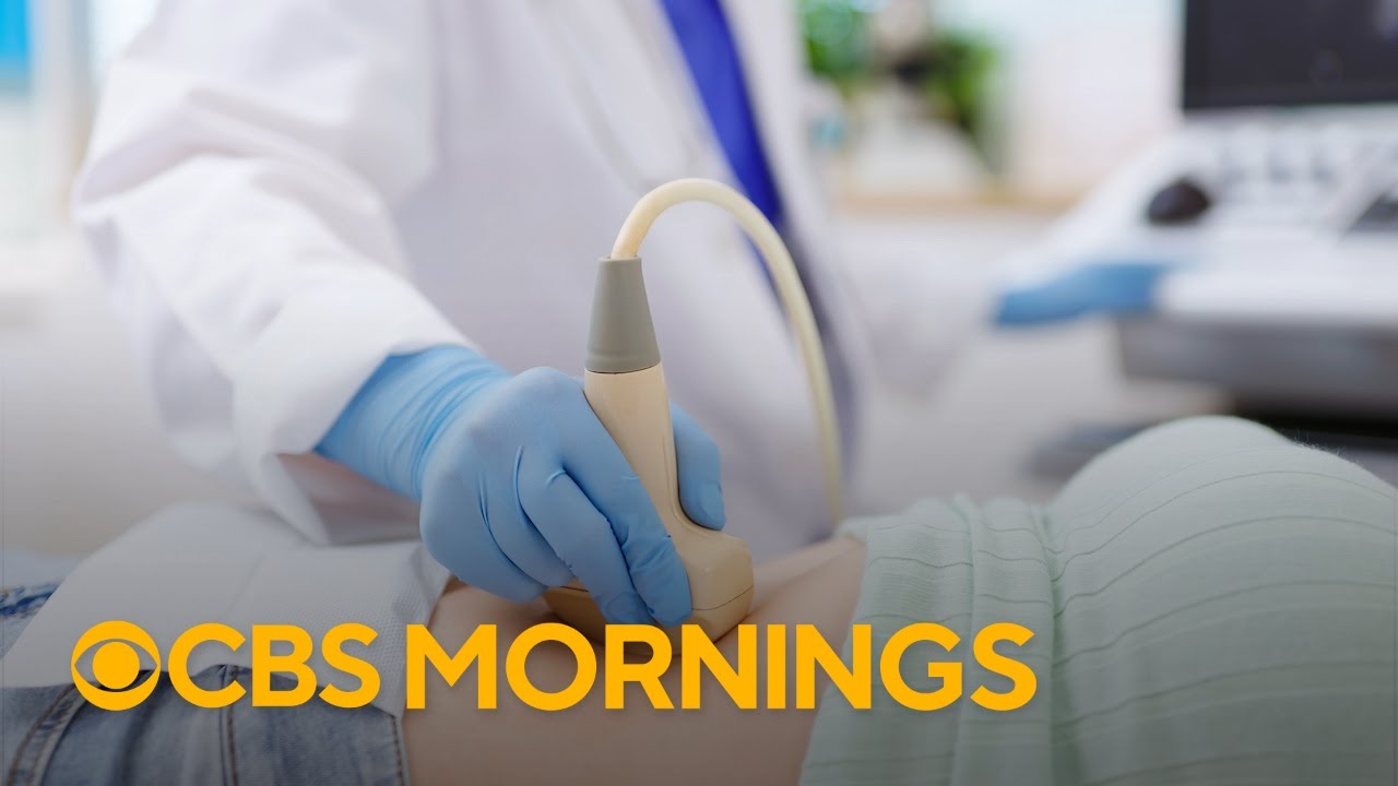 Expert on how fibroids impact women's health, available treatments