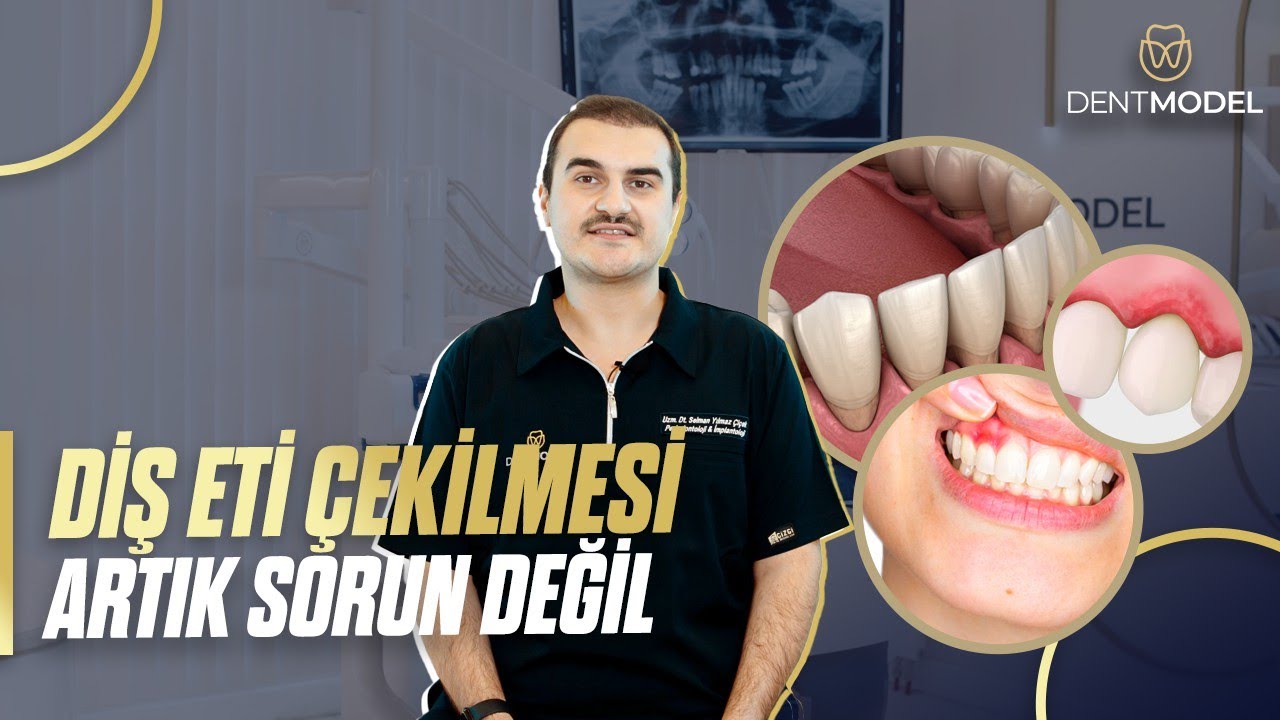 Diş Eti Çekilmesi Neden Olur? | Periodontoloji Uzmanı Uzm. Dt. Selman Yılmaz Çiçek | DENTMODEL 🦷✨