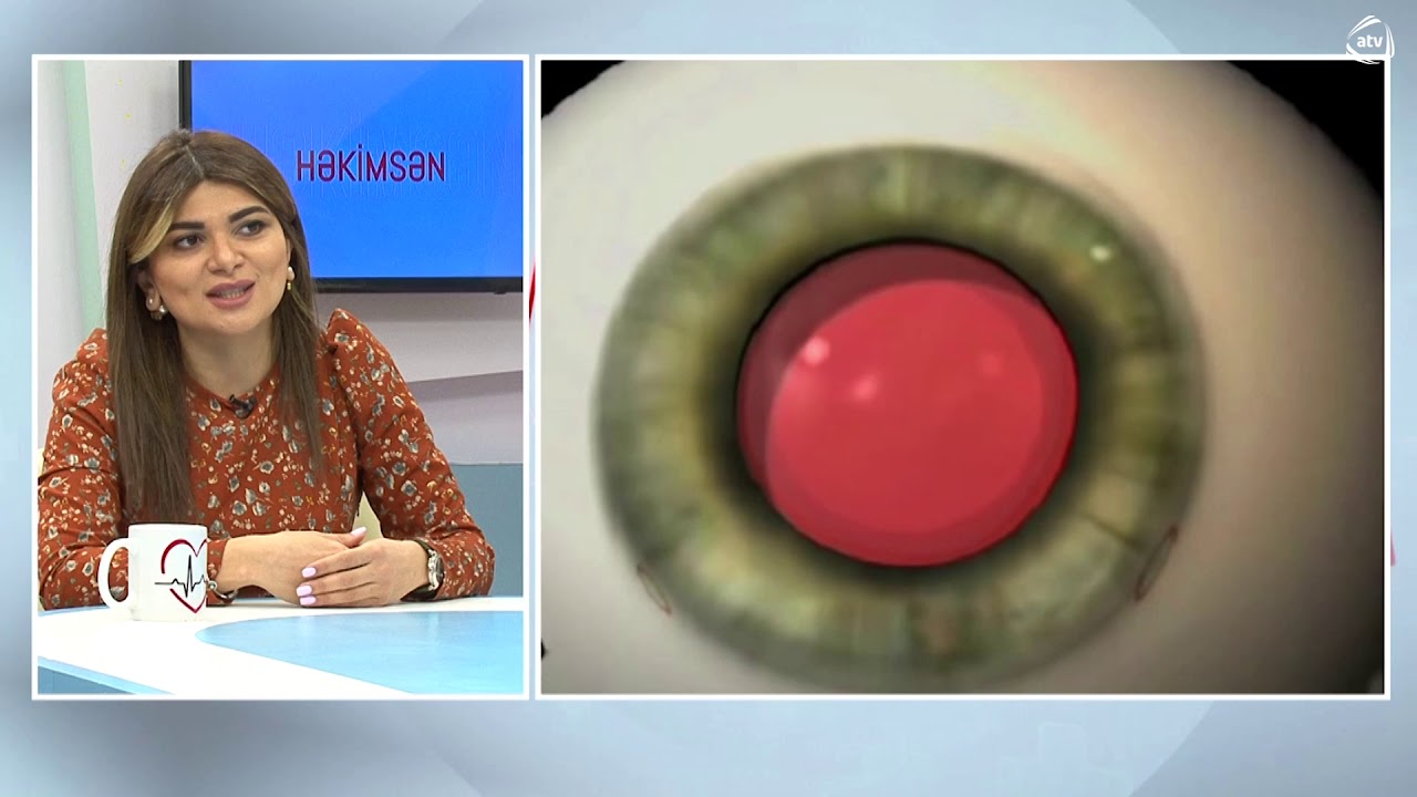 katarakta əməliyyatında istifadə olunan linzaların fərqi, trifokal- üç mərkəzli, ağıllı linzalar