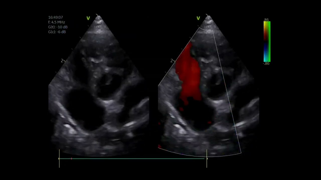 Pulmonary Hypertension in a dog
