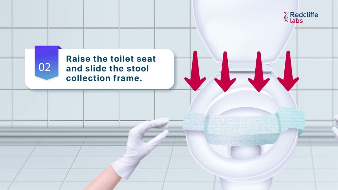 Gutmicrobiome Sample Collection Instructions | Redcliffe Labs