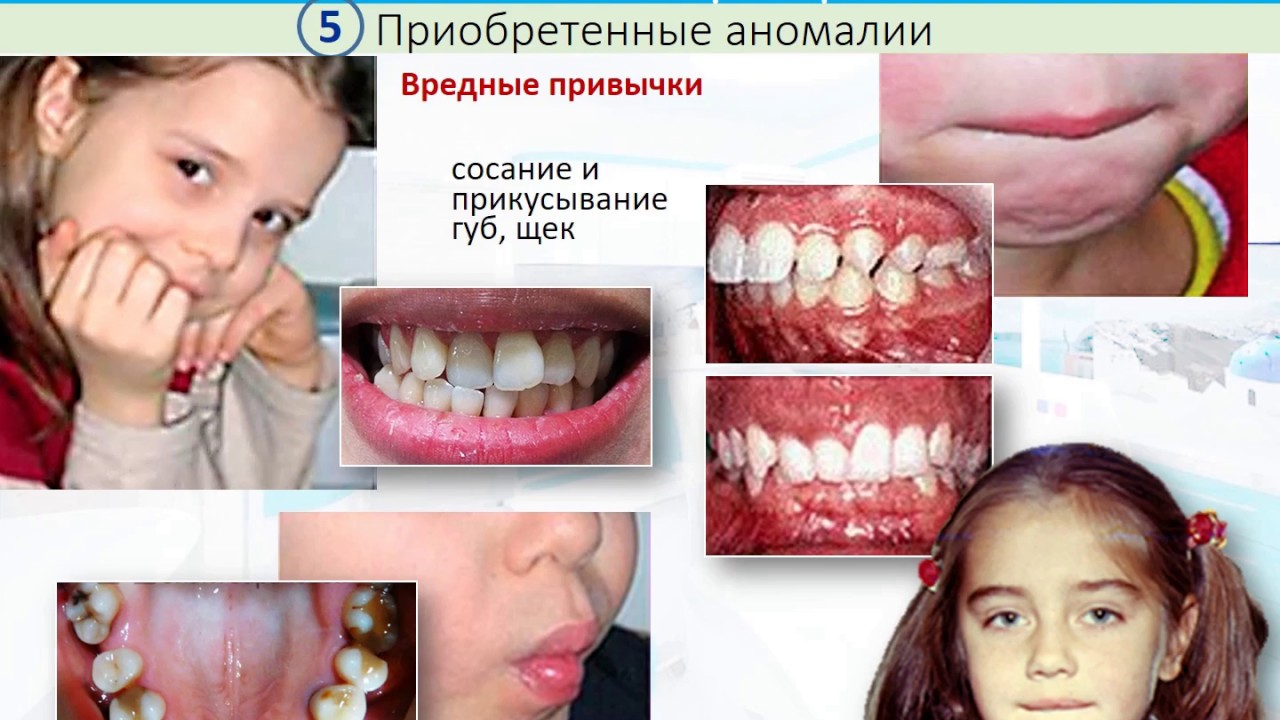 04 Этиология ЗЧА