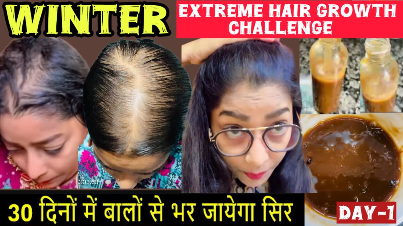 ✨15 Days *Winter Extreme Hair Growth Challenge*Day-1💕Fastest Hair Growth Serum👍#haircare#viralvideo