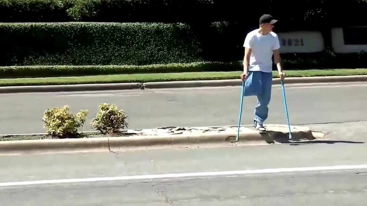 Above-Knee Amputee Swing-Through Crutching