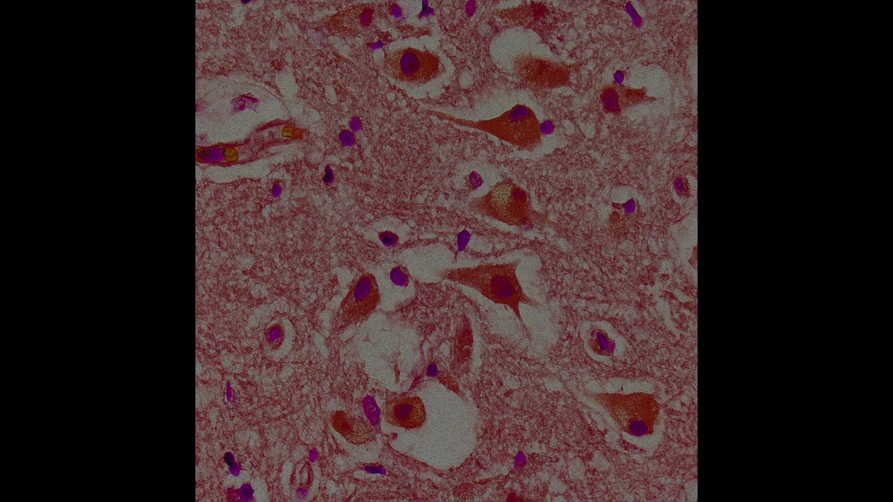 Fatih Tuter - Who is Fooling Who