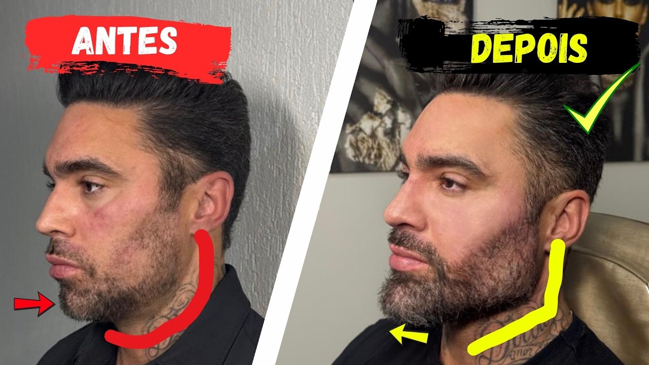 Harmonização Facial: Resultado e Manutenção a longo prazo