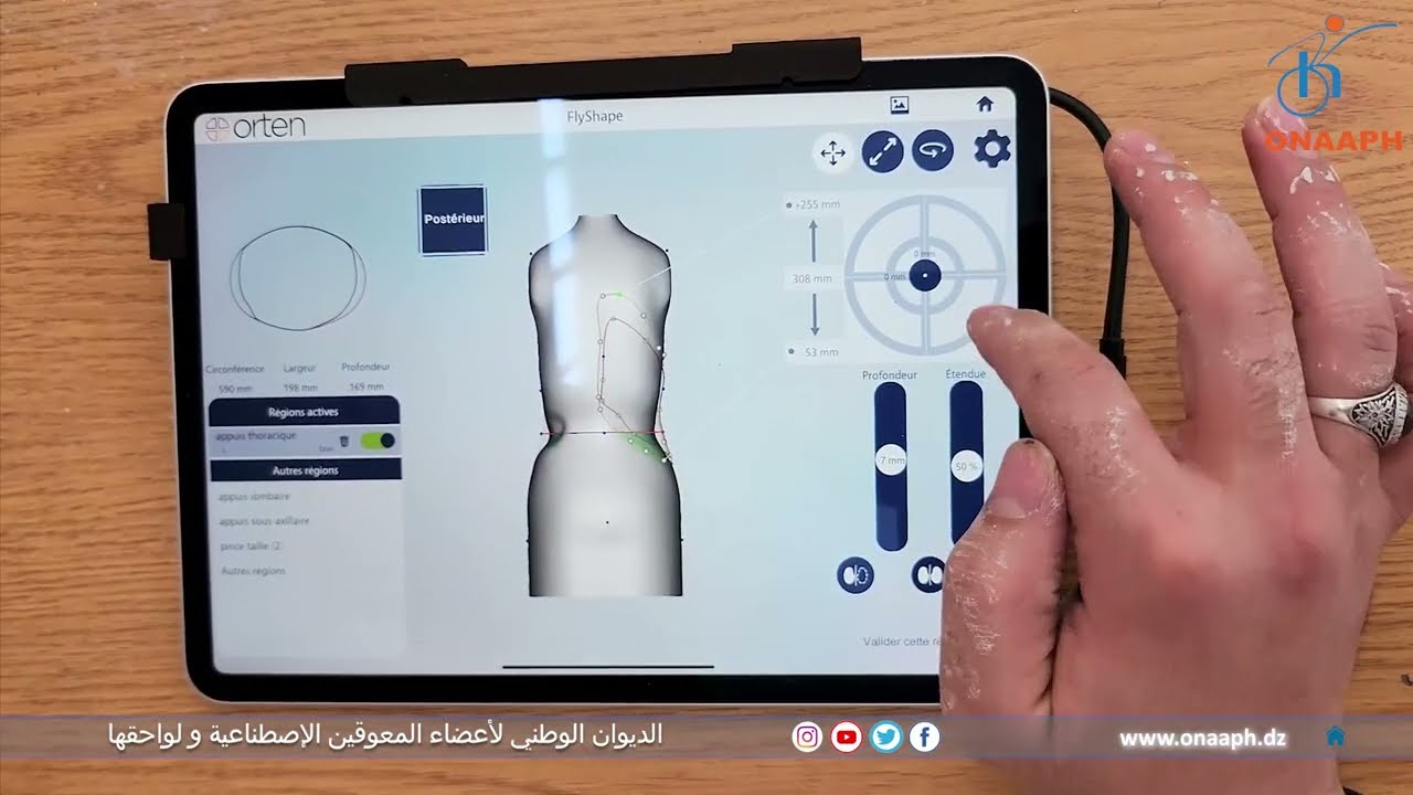 روبرتاج  حول المحطة الجهوية لصناعة المثبتات التجبيرية عن طريق الحاسوب و المسح الضوئي