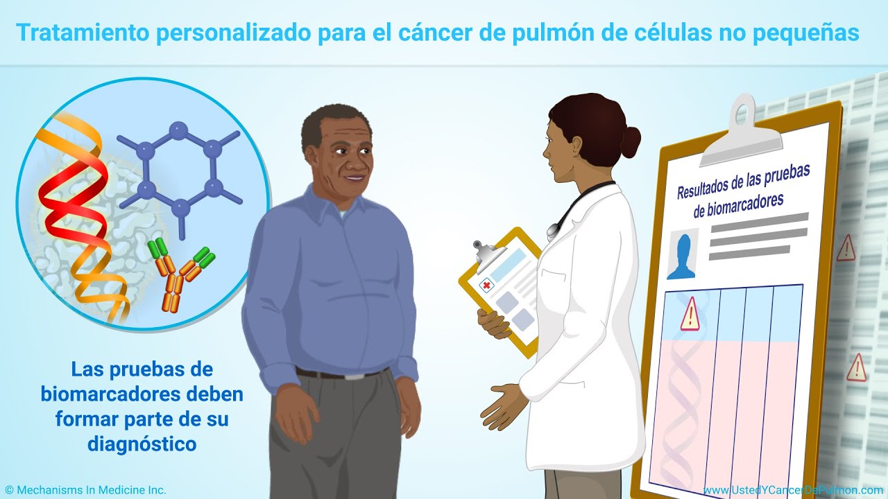 Comprender las pruebas de biomarcadores de cáncer de pulmón de células no pequeñas