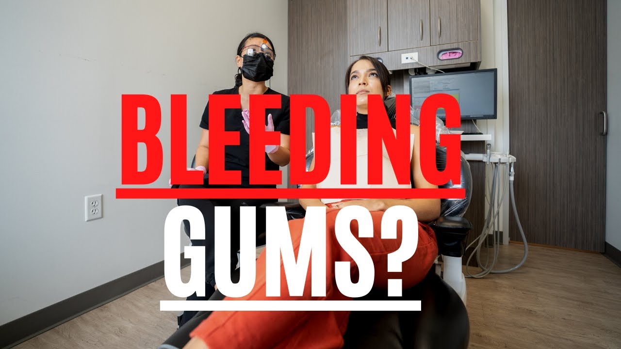 Why Do my Gums Bleed? // 3 Reasons Your Gums May Be BLEEDING!