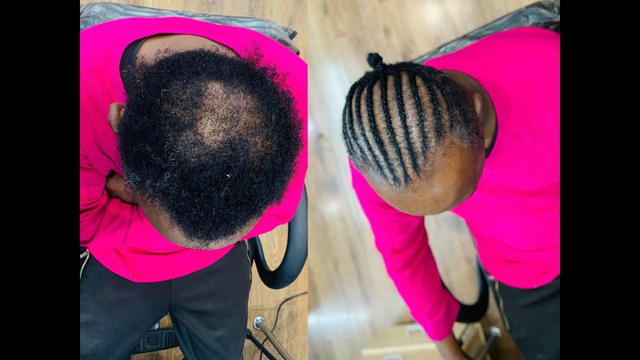 Detailed HOW TO BRAID OVER BALD PATCHES in real time speed.