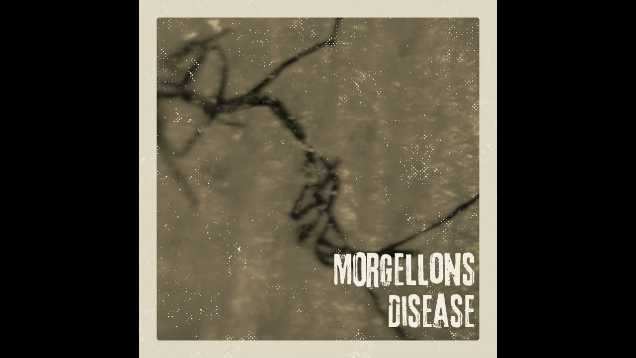 Morgellons Disease &ndash; Medical Mystery, Contested Illness, and the Human Cost of Disbelief