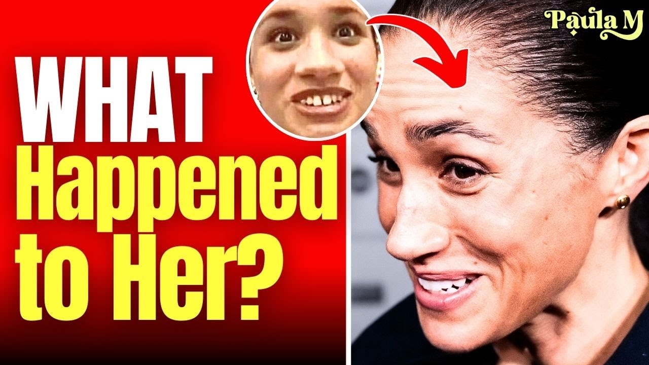 Beauty Expert EXPLAINS WHY Meghan Markle's Face Look Like This!