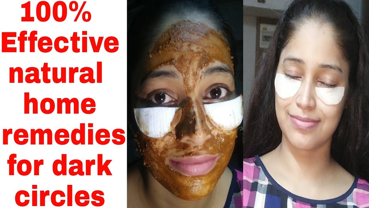 Dark circles को 100% खत्म करें हमेशा के लिए |Remove dark circles 100%natural remedy & guarantee