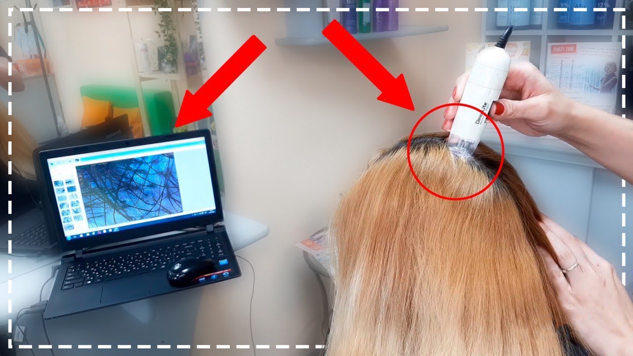 Как выявить проблемы кожи головы и волос? Аппаратная диагностика кожи головы и волос