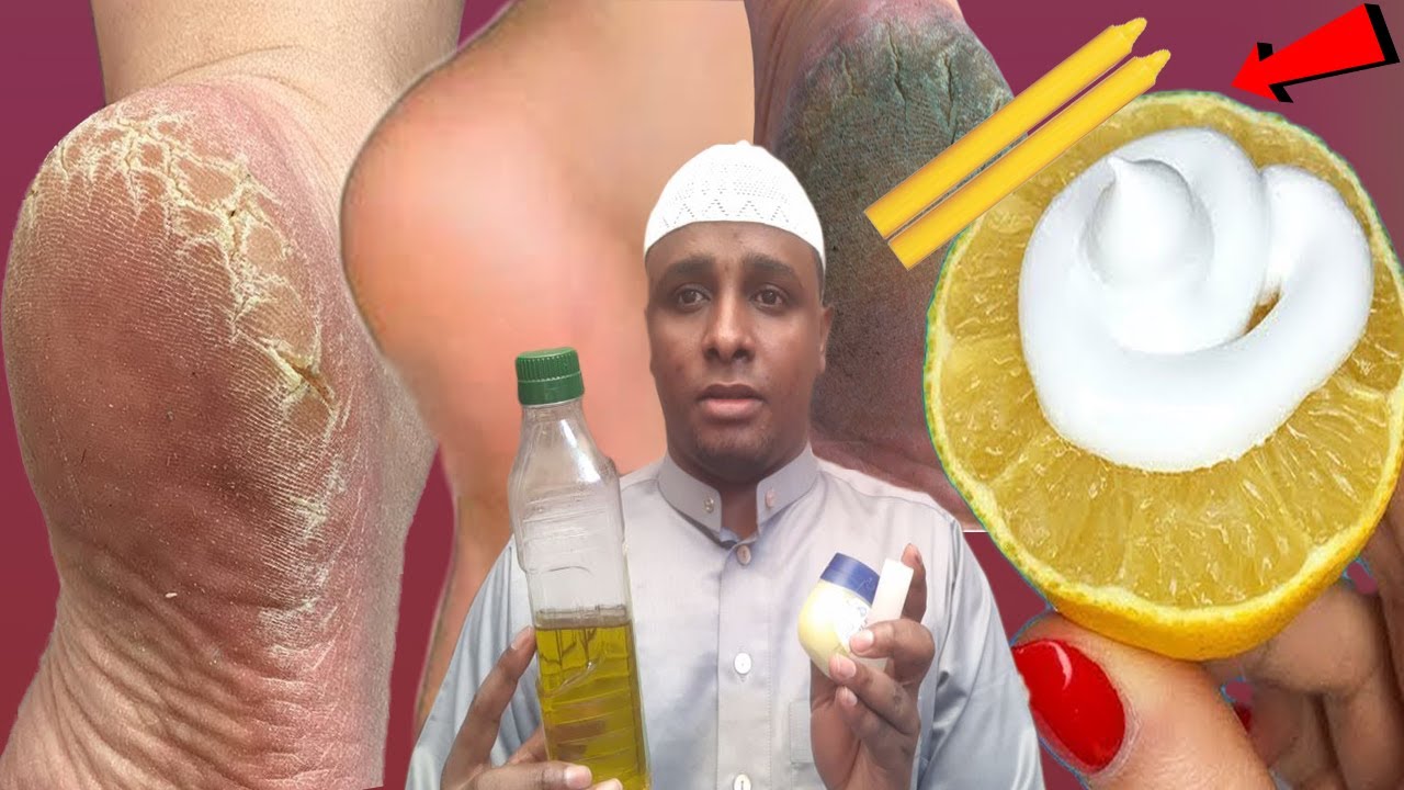 Cirba jeexa Hal maalin oga takhalus Alaabtan marso isku arki meysid