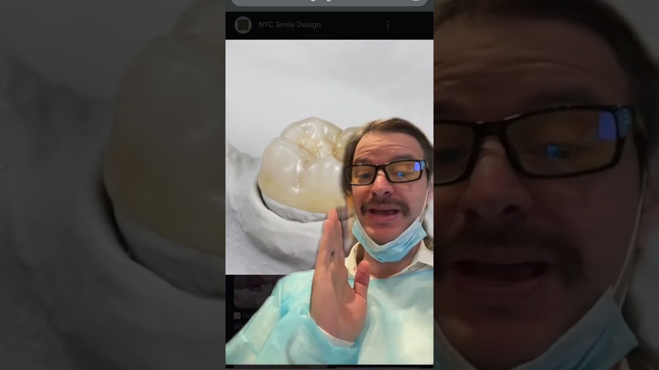 Gold and Porcelain Dental Crown Information