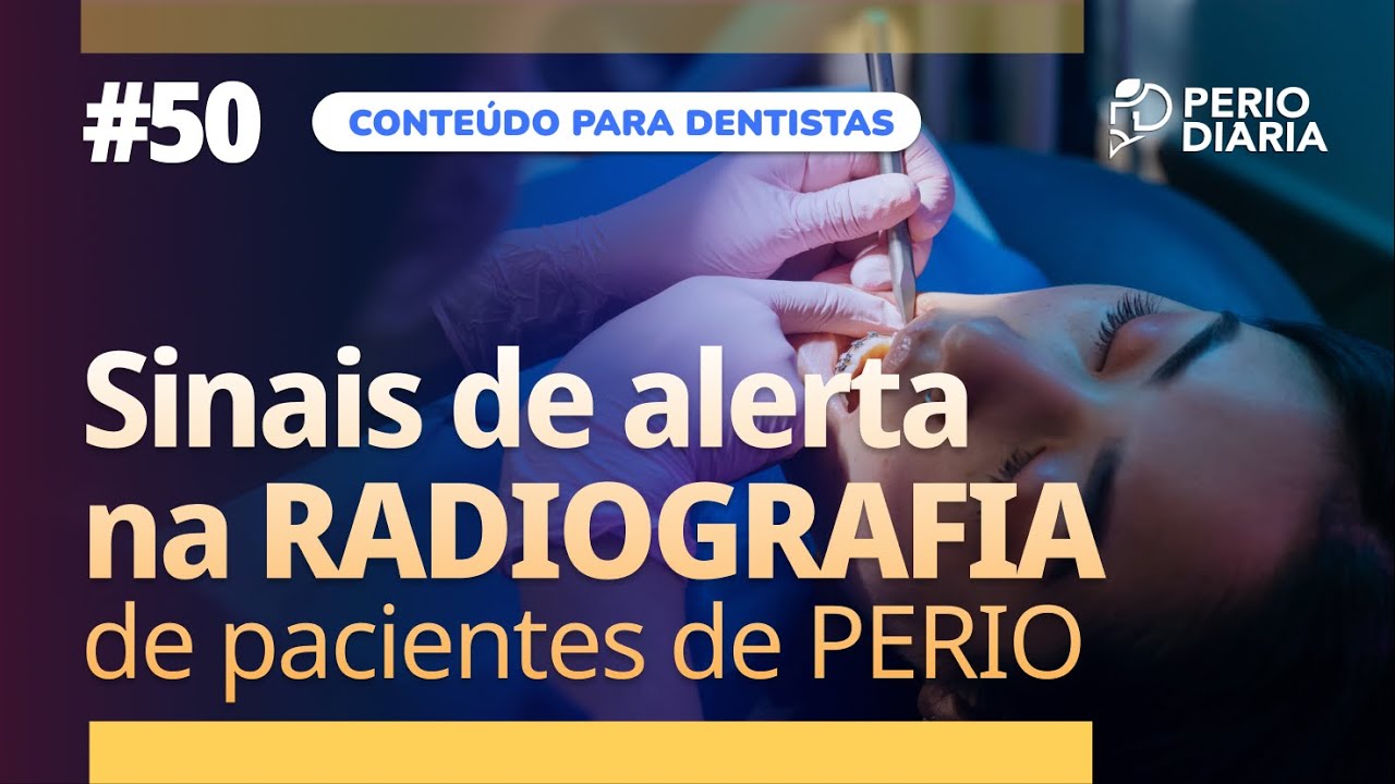 #50 - Sinais de alerta na RADIOGRAFIA de pacientes de PERIO