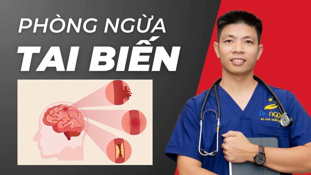Đừng bỏ qua 6 cách Phòng Ngừa Tai Biến Mạch Máu Não hiệu quả ai cũng làm được | Dr Ngọc