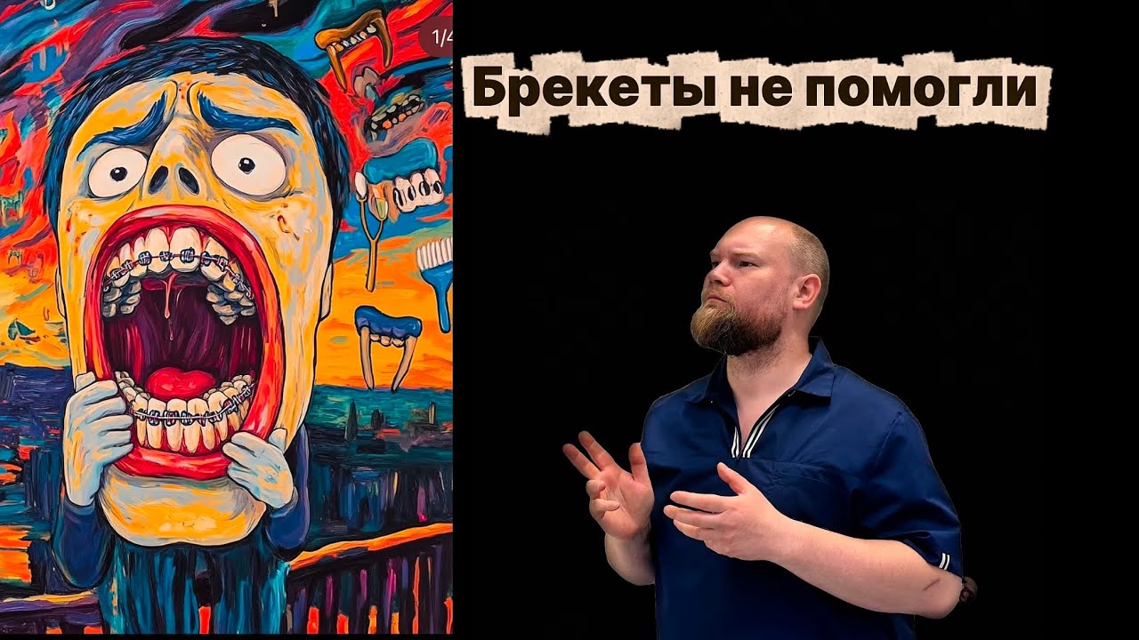 Не всегда ортодонтическое лечение приводит к желаемому результату 