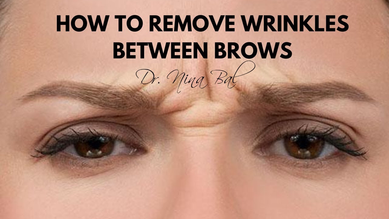 How To Get Rid Of Wrinkles Between Eyebrows 💕 Dr Nina Bal, Glabellar Lines Removal