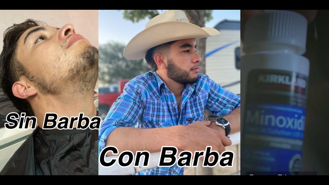 La Verdad Sobre EL Minoxidil - ¿Cómo Hacer Que Te Crezca La Barba?