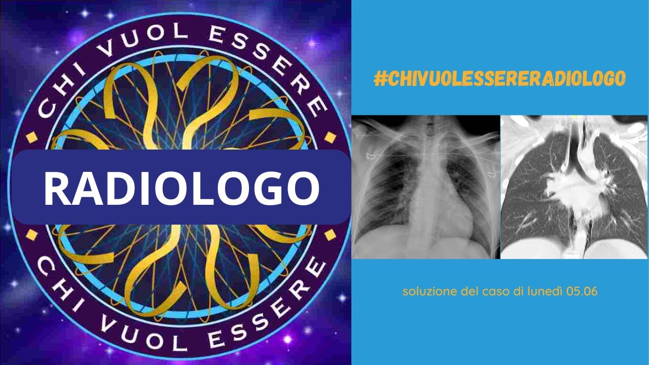 #chivuolessereradiologo - soluzione del 05.06 (pneumomediastino)