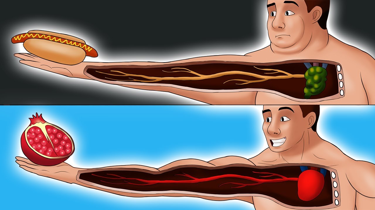9 Lebensmittel, die Arterien verstopfen (und 9, die sie wieder frei machen)