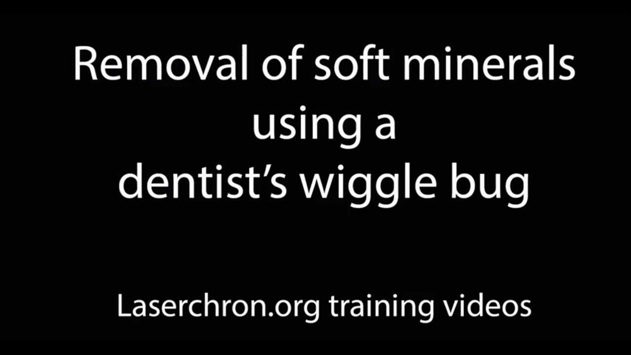 Minsep - Barite Removal with vibratory amalgamator