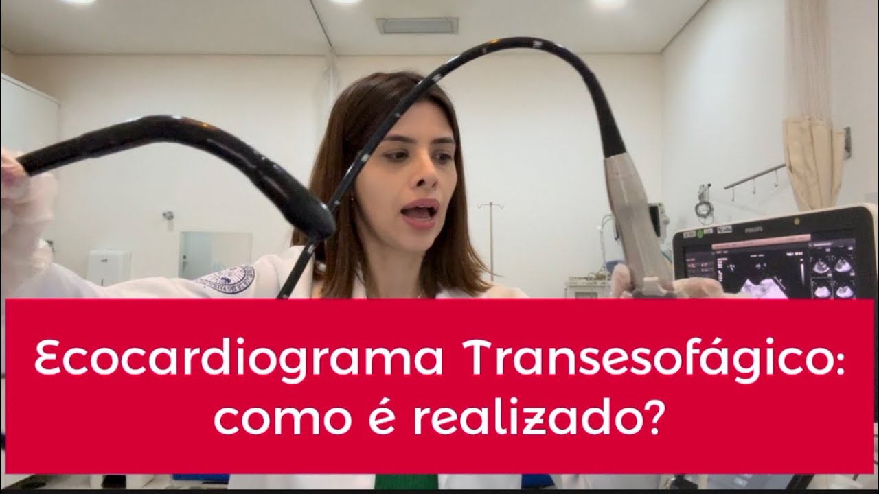 Ecocardiograma Transesofágico: como é realizado?