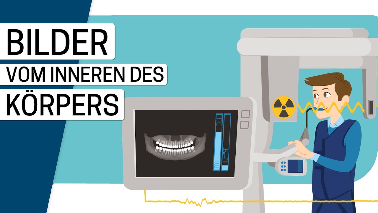 Wie funktioniert Röntgen?