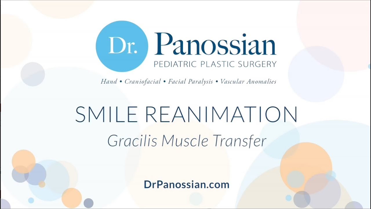Smile Reanimation using Gracilis Muscle Transfer