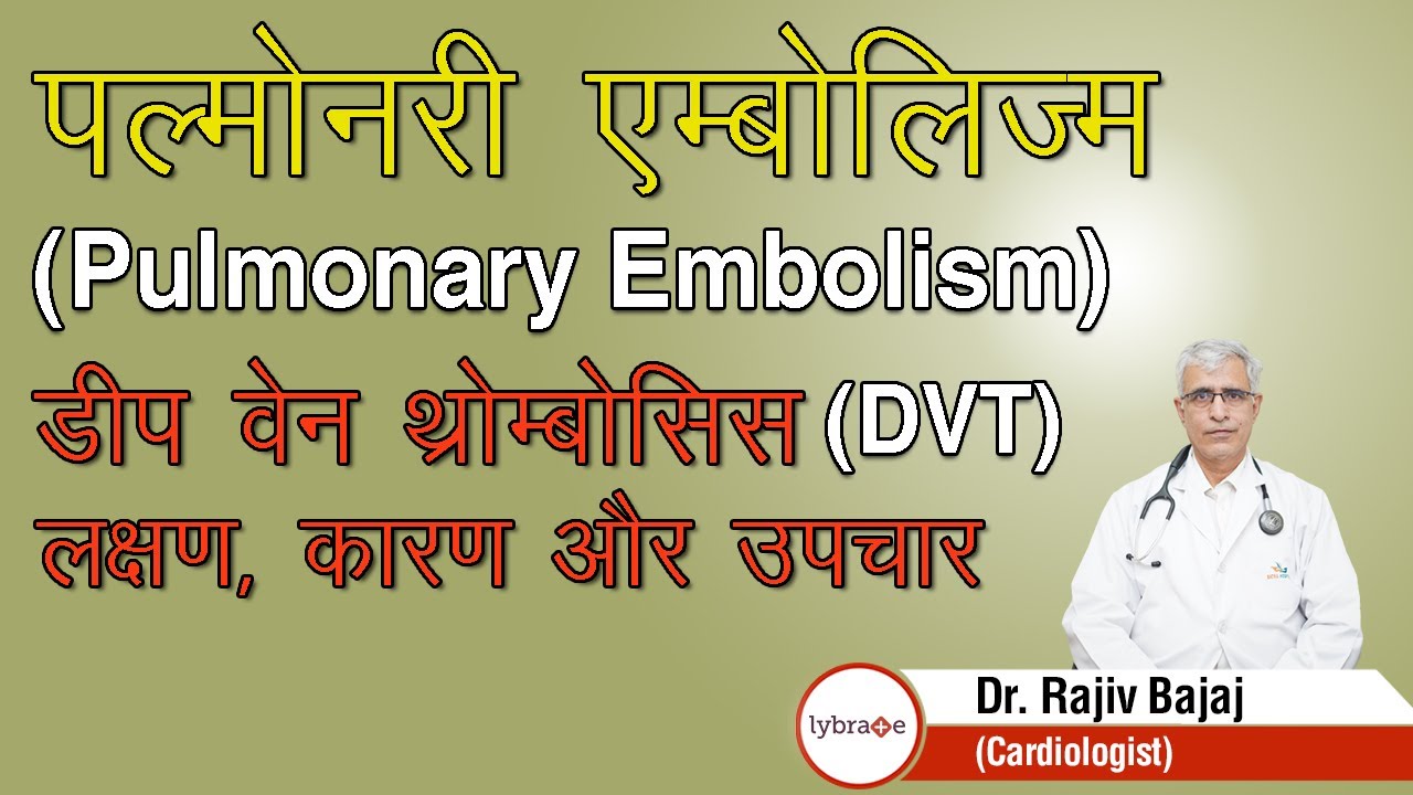 पल्मोनरी एम्बोलिज्म (Pulmonary Embolism), डीप वेन थ्रोम्बोसिस (DVT) लक्षण, कारण और उपचार | Lybrate