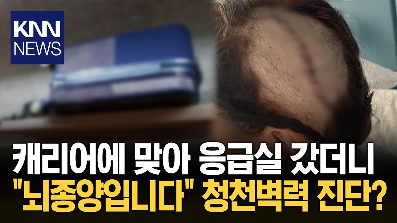 기차서 짐가방 맞고 응급실행 20대 여성, '시한부' 판정? 반전 / KNN