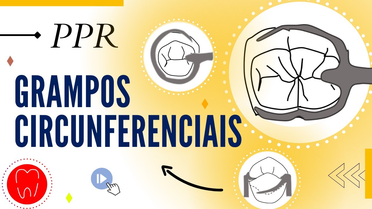 RETENTORES DIRETOS | GRAMPOS CIRCUNFERENCIAIS