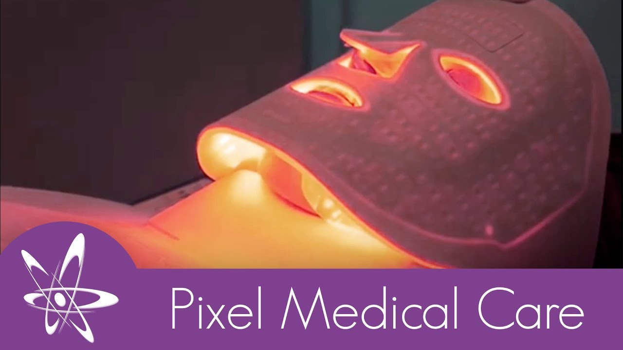 FOTOAGE | Elimina Acn&eacute;, Melasma, Rosacea, Manchas | Pixel Medical Care