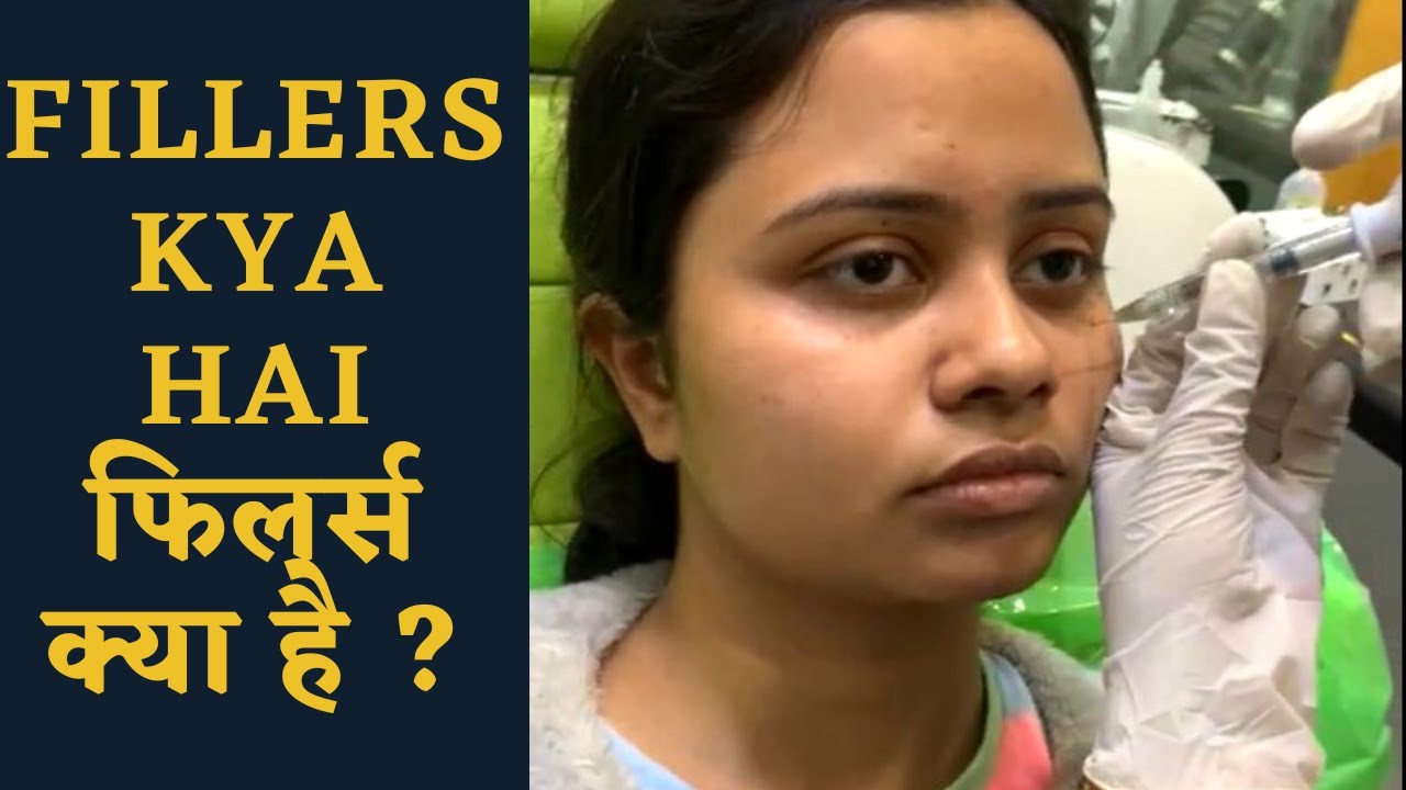 Fillers Kya hai फिलर्स क्या है?|Fillers Injection method for wrinkles,rejuvenation / Dr uttam  Lenka