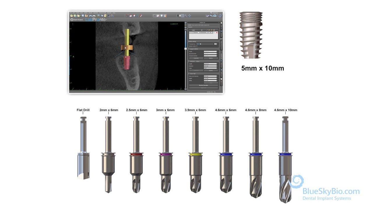 Bio | Max Fully Guided Keyless Surgical Kit
