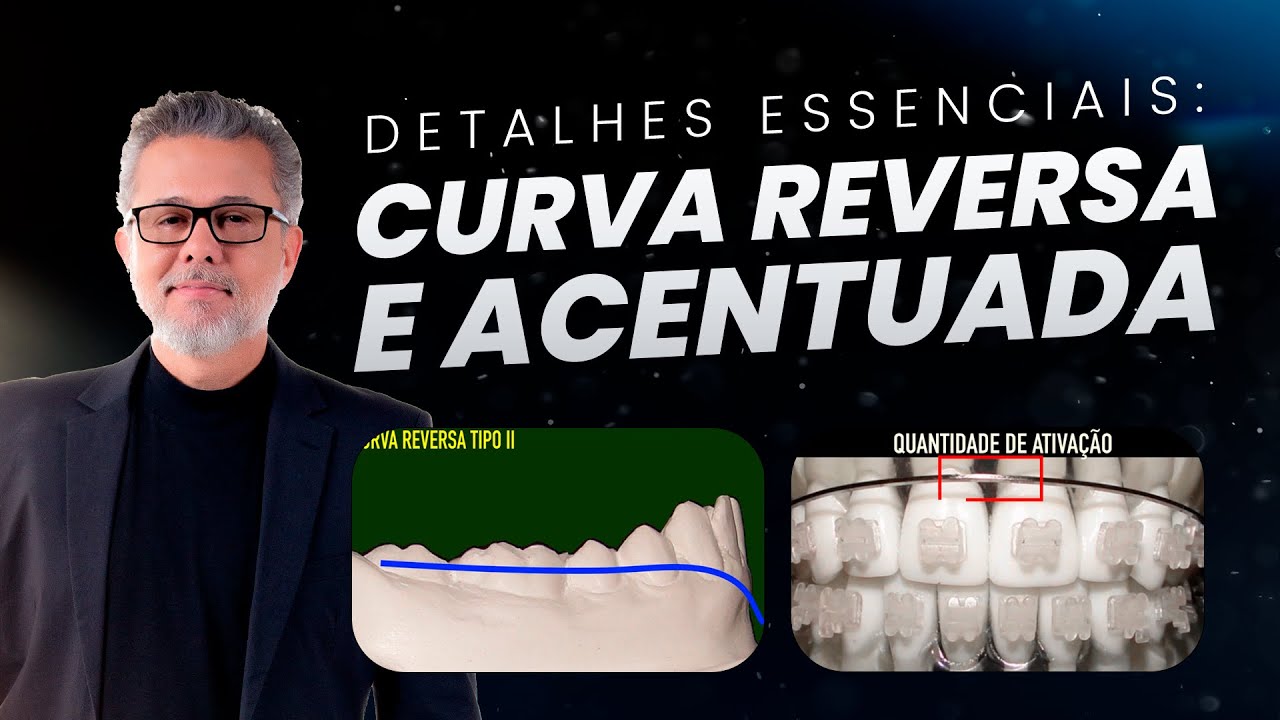 Entenda a Curva Reversa e Acentuada: Tudo que Você Precisa Saber!